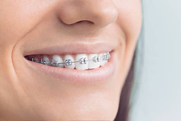 Best Root Canal Treatment  in Huntgton, IN